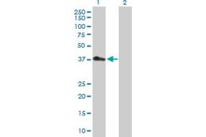 Western Blot analysis of PDCD2L expression in transfected 293T cell line by PDCD2L MaxPab polyclonal antibody. (PDCD2L antibody  (AA 1-358))