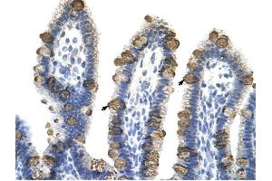 EXOSC3 antibody was used for immunohistochemistry at a concentration of 4-8 ug/ml to stain Epithelial cells of intestinal villus (arrows) in Human Intestine.