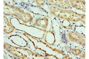 Immunohistochemistry of paraffin-embedded human kidney tissue using ABIN7146050 at dilution of 1:100 (CLEC11A antibody  (AA 22-323))