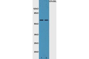 Lane 1: mouse liver lysates Lane 2: mouse intestine probed with Rabbit Anti-IL-22R Polyclonal Antibody, Unconjugated  at 1:5000 for 90 min at 37˚C.