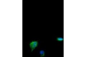Image no. 4 for anti-Cyclin-Dependent Kinase Inhibitor 2B (p15, Inhibits CDK4) (CDKN2B) antibody (ABIN1497447)