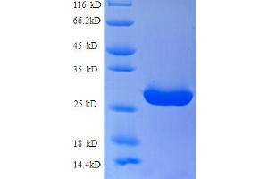 SDS-PAGE (SDS) image for Solute Carrier Family 26, Member 3 (SLC26A3) (AA 28-254) protein (His tag) (ABIN5713114)