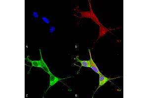 Immunocytochemistry/Immunofluorescence analysis using Mouse Anti-Copper Transporting ATPase 1 Monoclonal Antibody, Clone S60-4 (ABIN2485181). (ATP7A antibody  (AA 42-61) (Atto 390))