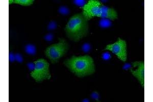 Image no. 7 for anti-Transforming, Acidic Coiled-Coil Containing Protein 3 (TACC3) antibody (ABIN1498098) (TACC3 antibody)