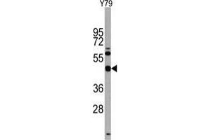 Western blot analysis of anti-TGIF1 Antibody (Center) in Y79 cell line lysates (35 µg/lane).