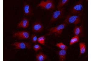 IF analysis of Nanog using anti-Nanog antibody (ABIN7599059). (Nanog antibody  (AA 1-191))