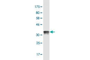 Western Blot detection against Immunogen (36. (CGB antibody  (AA 70-165))