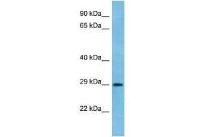 WB Suggested Anti-RAB6C Antibody Titration: 1. (WTH3DI antibody  (C-Term))