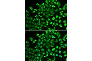 Immunofluorescence analysis of U2OS cells using MMRN1 antibody (ABIN5974009). (Multimerin 1 antibody)
