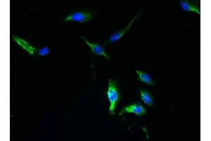 Immunofluorescent analysis of Hela cells using ABIN7166225 at dilution of 1:100 and Alexa Fluor 488-congugated AffiniPure Goat Anti-Rabbit IgG(H+L) (TTYH1 antibody  (AA 50-178))