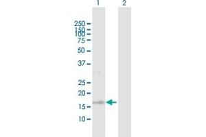 Western Blot analysis of TSC22D1 expression in transfected 293T cell line by TSC22D1 MaxPab polyclonal antibody. (TSC22D1 antibody  (AA 1-144))