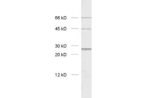 dilution: 1 : 1000, sample: rat brain homogenate (CHRNB1 antibody)