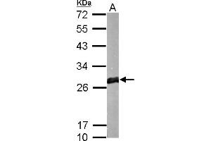 WB Image GSTM1 antibody detects protein by Western blot analysis. (GSTM1 antibody)