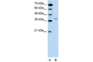 RAPSN antibody used at 0.