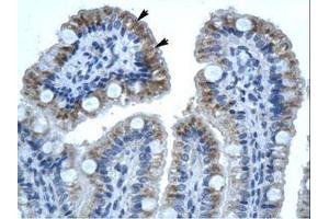 Image no. 1 for anti-Gap Junction Protein, beta 1, 32kDa (GJB1) (C-Term) antibody (ABIN202156) (GJB1 antibody  (C-Term))