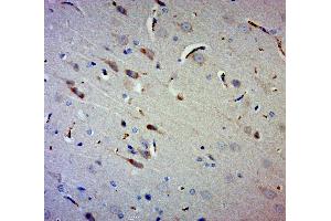 Paraformaldehyde-fixed, paraffin embedded rat brain, Antigen retrieval by boiling in sodium citrate buffer (pH6. (GAN antibody  (AA 351-450))