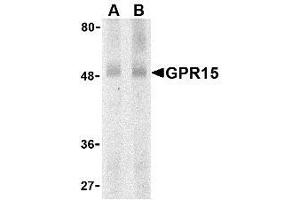 Western blot analysis of GPR15 in human spleen lysate with AP30376PU-N GPR15 antibody at (A) 0. (GPR15 antibody  (N-Term))