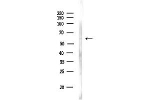 anti-RNA Polymerase II Associated Protein 2 (RPAP2) (Internal Region) antibody