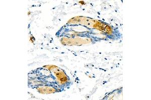 Immunohistochemistry of paraffin embedded mouse skin using CK13 (ABIN7074411) at dilution of 1:1200 (400x lens)