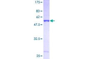 CA3 Protein (AA 1-260) (GST tag)