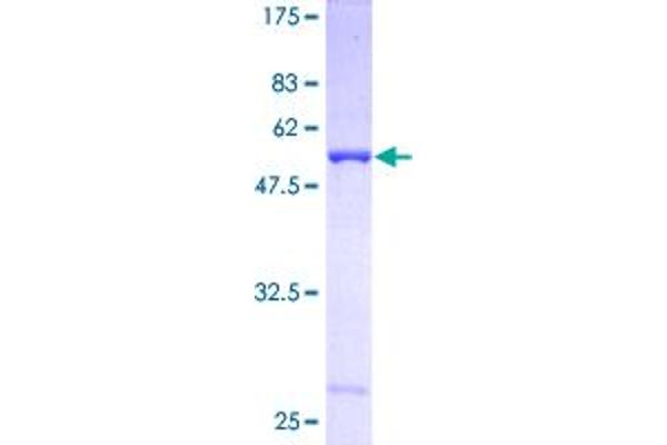 CA3 Protein (AA 1-260) (GST tag)