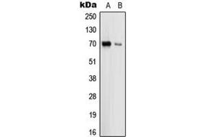 Western blot analysis of Uromodulin expression in HEK293T (A), THP1 (B) whole cell lysates. (Uromodulin antibody  (Center))