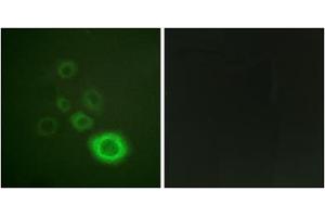 Immunofluorescence analysis of A549 cells, using c-Met (epitope around residue 1003) antibody. (c-MET antibody  (Tyr1003))