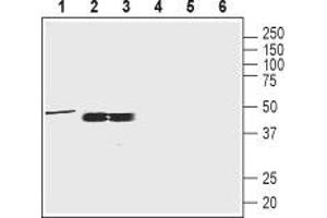 Western blot analysis of rat brain membrane (1:200), rat testis and mouse testis lysates (1:400): - 1-3. (Oxytocin Receptor antibody  (C-Term, Intracellular))