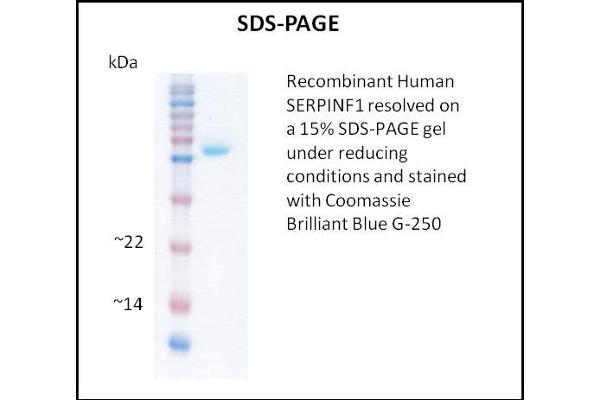 PEDF Protein