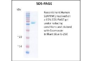 SDS-PAGE (SDS) image for serpin Peptidase Inhibitor, Clade F (Alpha-2 Antiplasmin, Pigment Epithelium Derived Factor), Member 1 (SERPINF1) (Active) protein (ABIN5509380) (PEDF Protein)