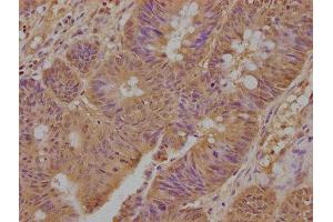 Immunohistochemistry (IHC) image for anti-Tumor Necrosis Factor Receptor Superfamily, Member 1A (TNFRSF1A) (AA 249-455) antibody (ABIN7173872)