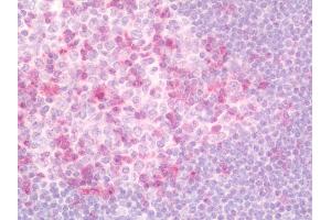 Human Tonsil: Formalin-Fixed, Paraffin-Embedded (FFPE). (SKAP1 antibody  (FITC))