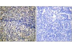 Immunohistochemistry analysis of paraffin-embedded human tonsil tissue, using p47 phox (Ab-328) Antibody. (NCF1 antibody  (AA 301-350))