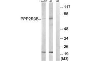 Western blot analysis of extracts from Jurkat/HuvEc cells, using PPP2R5D Antibody. (PPP2R5D antibody  (AA 544-593))