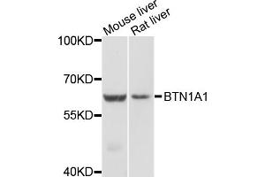 Western blot analysis of extracts of various cell lines, using BTN1A1 antibody (ABIN4903077) at 1:1000 dilution. (BTN1A1 antibody)