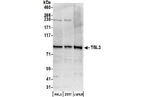 anti-Transducin (Beta)-Like 3 (TBL3) (AA 758-808) antibody