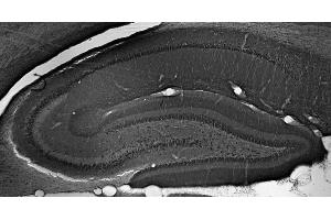 Adult rat hippocampus immunohistochemistry. (Peroxisomal Biogenesis Factor 5-Like (PEX5L) (AA 1-192), (Constant Region) antibody)