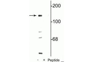 Western blot of mouse brain lysate showing specific immunolabeling of the ~140 kDa NR2C   subunit of the NMDA receptor phosphorylated at Ser1096 in the first lane (-). (GRIN2C antibody  (pSer1096))