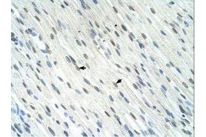 Image no. 1 for anti-SERTA Domain Containing 1 (SERTAD1) (N-Term) antibody (ABIN324352) (SERTAD1 antibody  (N-Term))