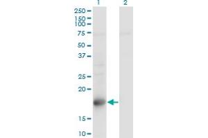 Western Blot analysis of TSC22D1 expression in transfected 293T cell line by TSC22D1 monoclonal antibody (M01), clone 1G7. (TSC22D1 antibody  (AA 1-144))