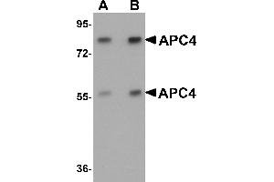 Western Blotting (WB) image for anti-Anaphase Promoting Complex Subunit 4 (ANAPC4) (N-Term) antibody (ABIN1031231) (ANAPC4 antibody  (N-Term))