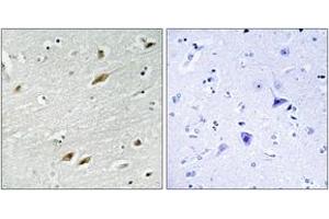 Immunohistochemistry (IHC) image for anti-Forkhead Box O1 (FOXO1) (AA 286-335) antibody (ABIN2888992) (FOXO1 antibody  (AA 286-335))