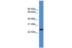 WB Suggested Anti-CD28 Antibody Titration: 0. (CD28 antibody  (C-Term))