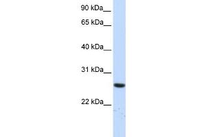 WB Suggested Anti-TTC33 Antibody Titration: 0. (TTC33 antibody  (N-Term))