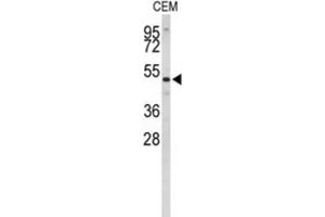 Western Blotting (WB) image for anti-Carnosine Dipeptidase 1 (Metallopeptidase M20 Family) (CNDP1) antibody (ABIN3004062) (CNDP1 antibody)