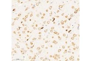 Immunohistochemistry analysis of paraffin-embedded rat brain using,RPL8 (ABIN7075442) at dilution of 1: 3000 (RPL8 antibody)