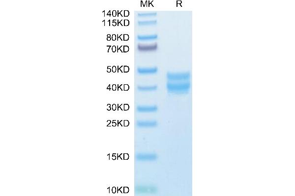 BST1 Protein (AA 25-286) (His tag)