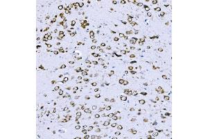IHC analysis of VPRBP/DCAF1 using anti-VPRBP/DCAF1 antibody (ABIN7602005). (DDB1 and CUL4-Associated Factor 1 (DCAF1) (AA 540-861) antibody)