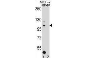 Western Blotting (WB) image for anti-Homeodomain Interacting Protein Kinase 1 (HIPK1) antibody (ABIN2996765) (HIPK1 antibody)