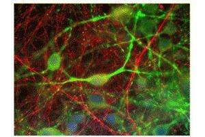 Immunostaining of cultured rat CNS cells showing specific labeling of alpha-internexin in neuronal processes in red and microtubule associated protein 2 ( ABIN361345) in green. (INA antibody)